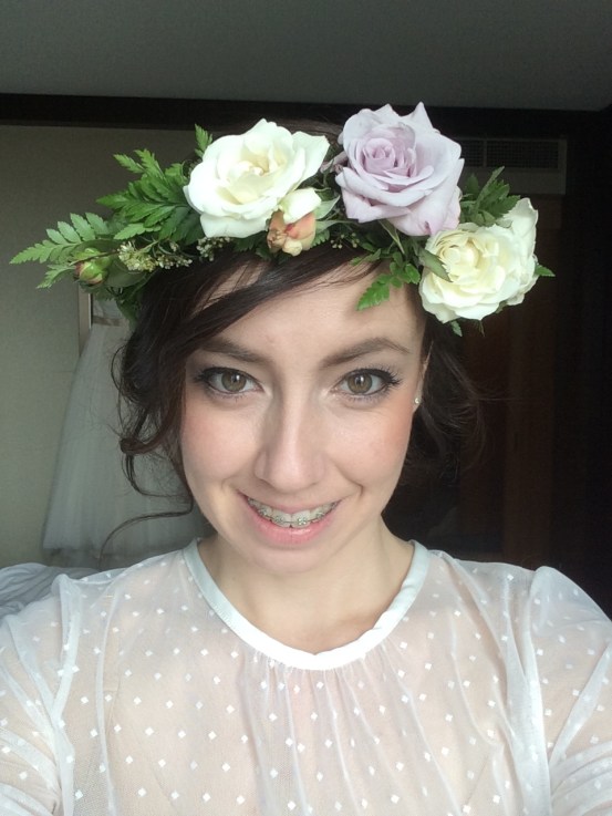 braces-clear-rubber-bands