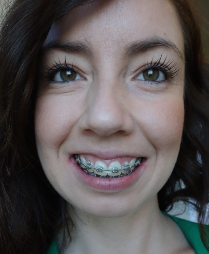 braces-month-22